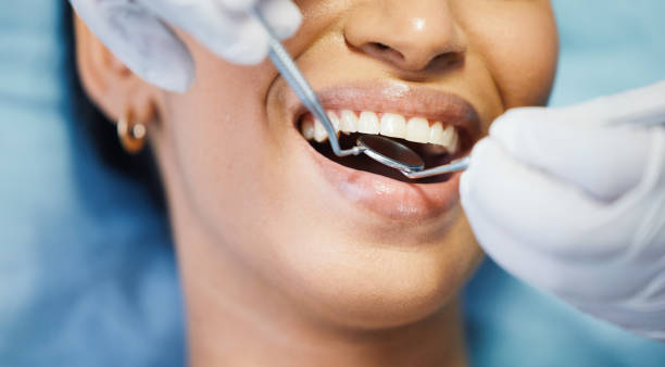 Best Emergency Dental Care for Trauma or Injury in Millport, AL